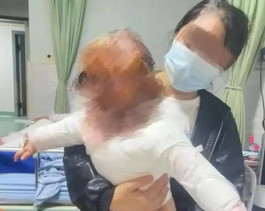 1岁童遭小熊养生壶炸伤，小熊电器百万台畅销品成 「安全杀手」？