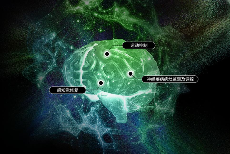 脑机接口+具身智能:阶梯医疗如何打通硬科技落地的双向闭环?
